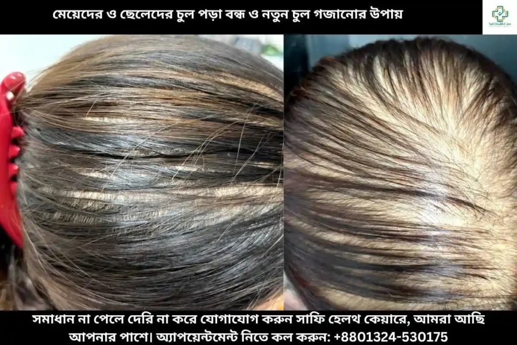 মেয়েদের ও ছেলেদের চুল পড়া বন্ধ ও নতুন চুল গজানোর উপায়